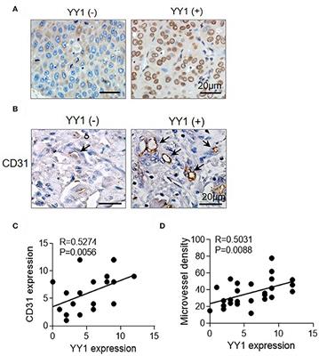 YY1 Promotes Endothelial Cell-Dependent Tumor Angiogenesis in Hepatocellular Carcinoma by Transcriptionally Activating VEGFA